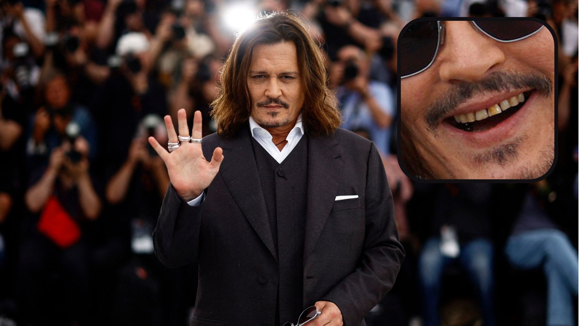 Johnny Depp Wife Teeth