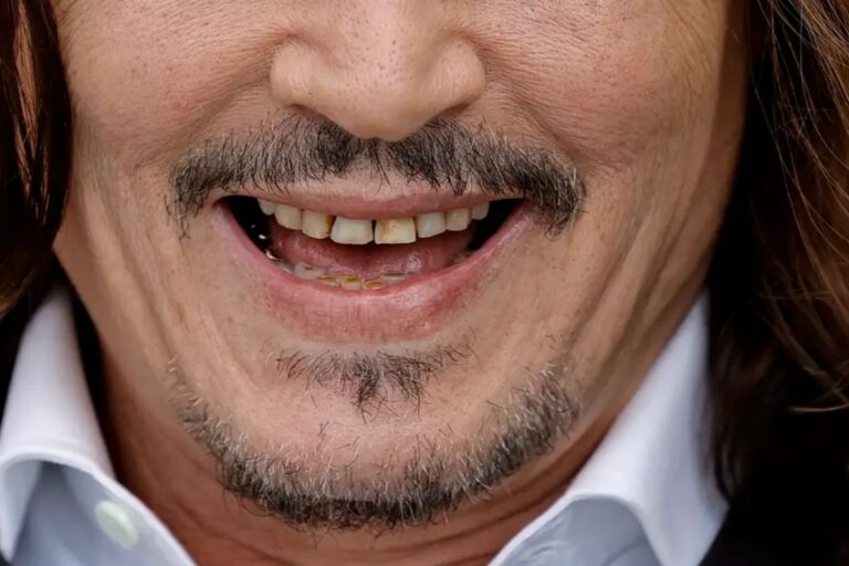 Johnny Depp Causes Disgust After Appearing With Rotten Teeth At Cannes