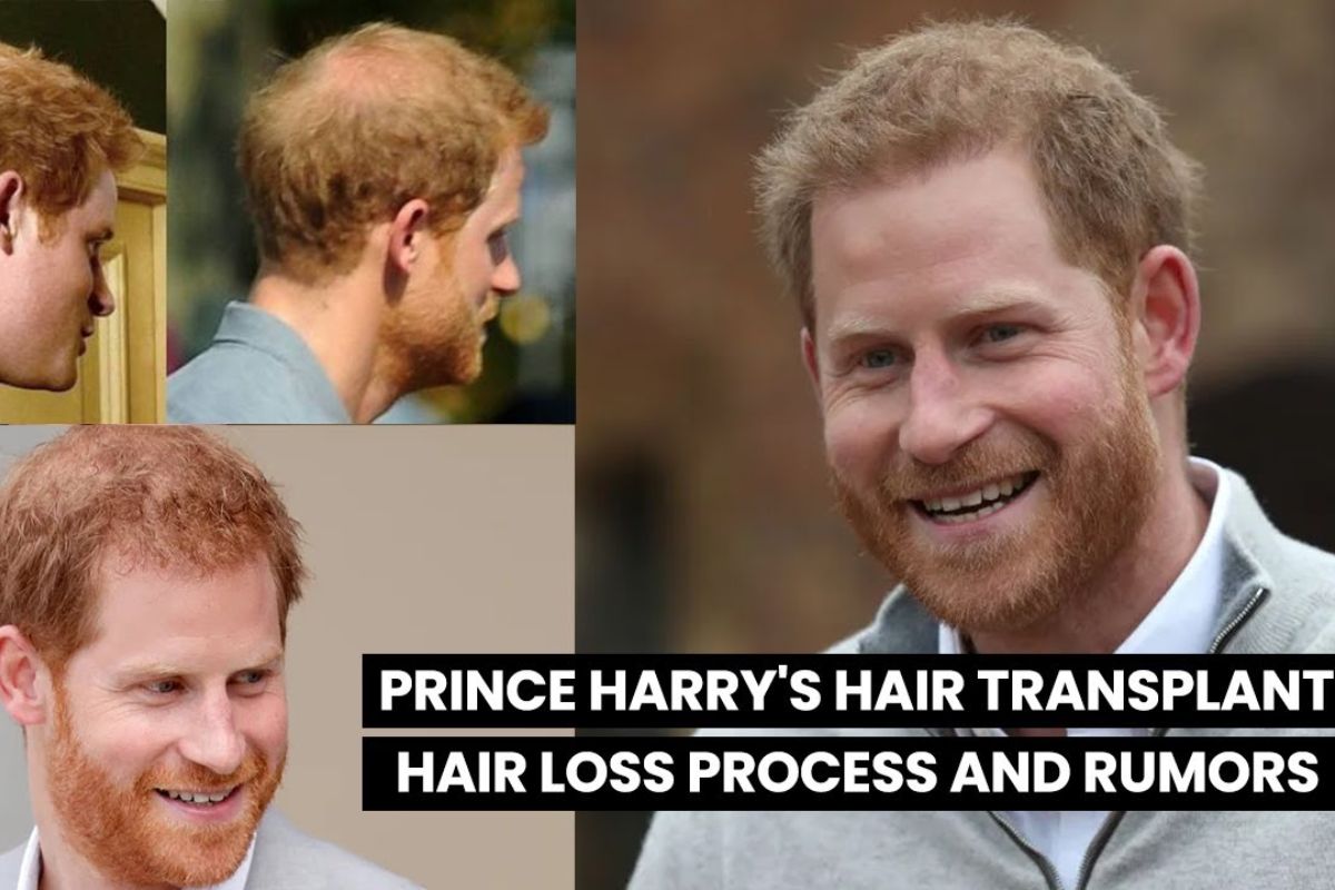 prince harry