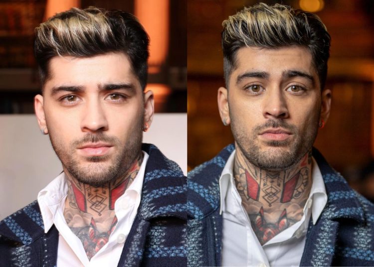 Zayn Malik Gives An Update Regarding His Foot After It Was Run Over By ...