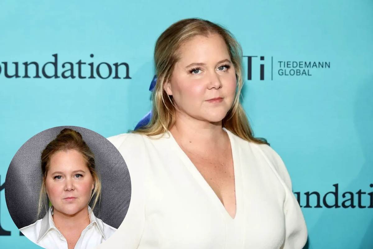 Amy Schumer has been diagnosed with Cushing's Syndrome