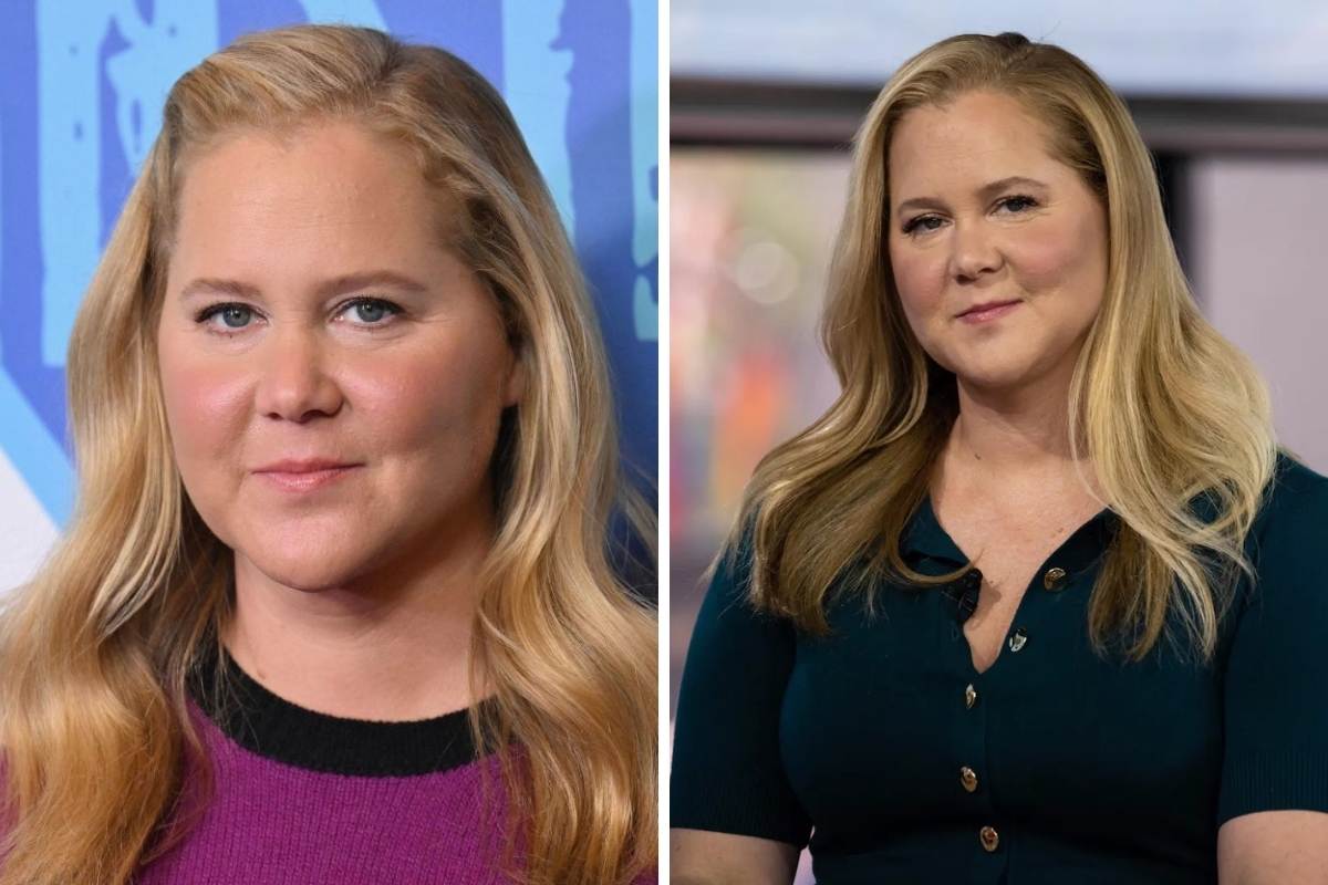 Amy Schumer has been diagnosed with Cushing's Syndrome