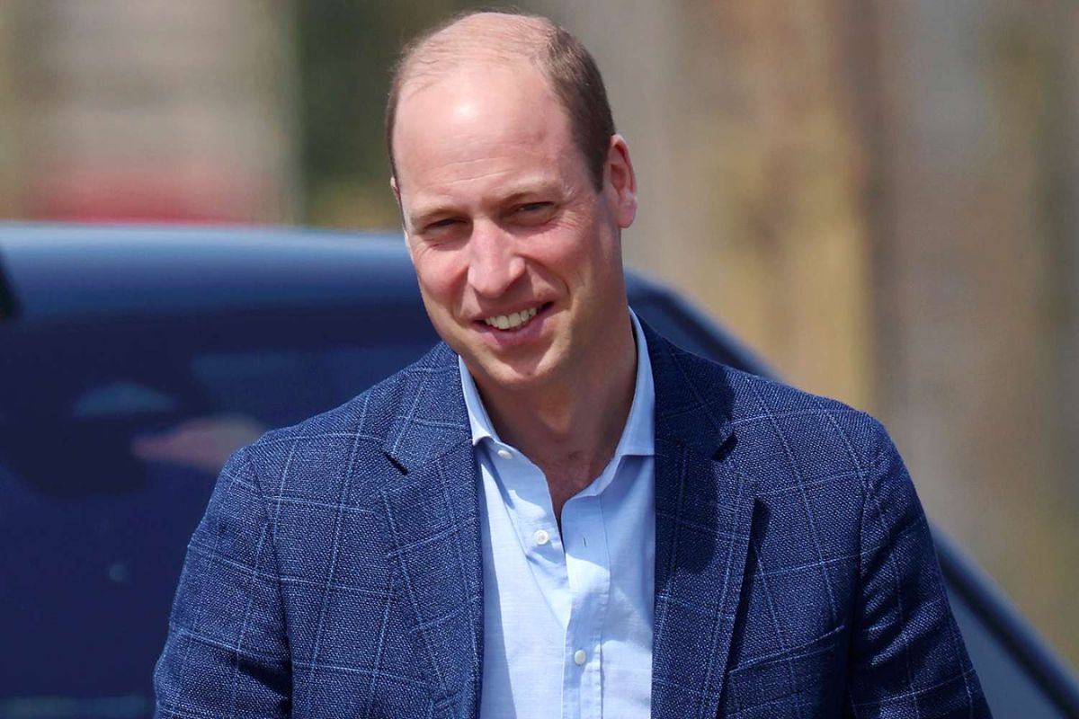 This would explain why Prince William does not get a hair implant to address his baldness