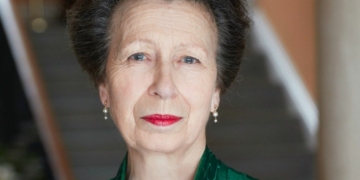 Princess Anne is suffering memory loss after a concussion