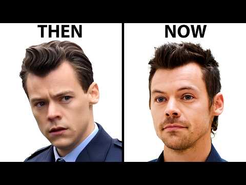 Harry Styles Hair Transplant | Plastic Surgery Analysis