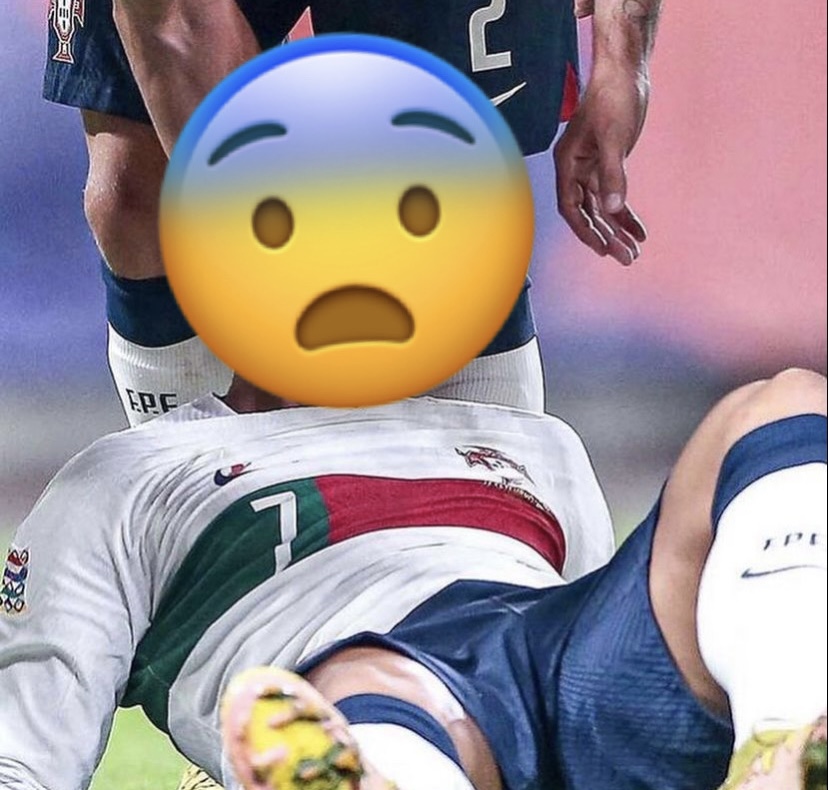 Tratamiento cáscara Montgomery Cristiano Ronaldo se desfigura el rostro en un accidente