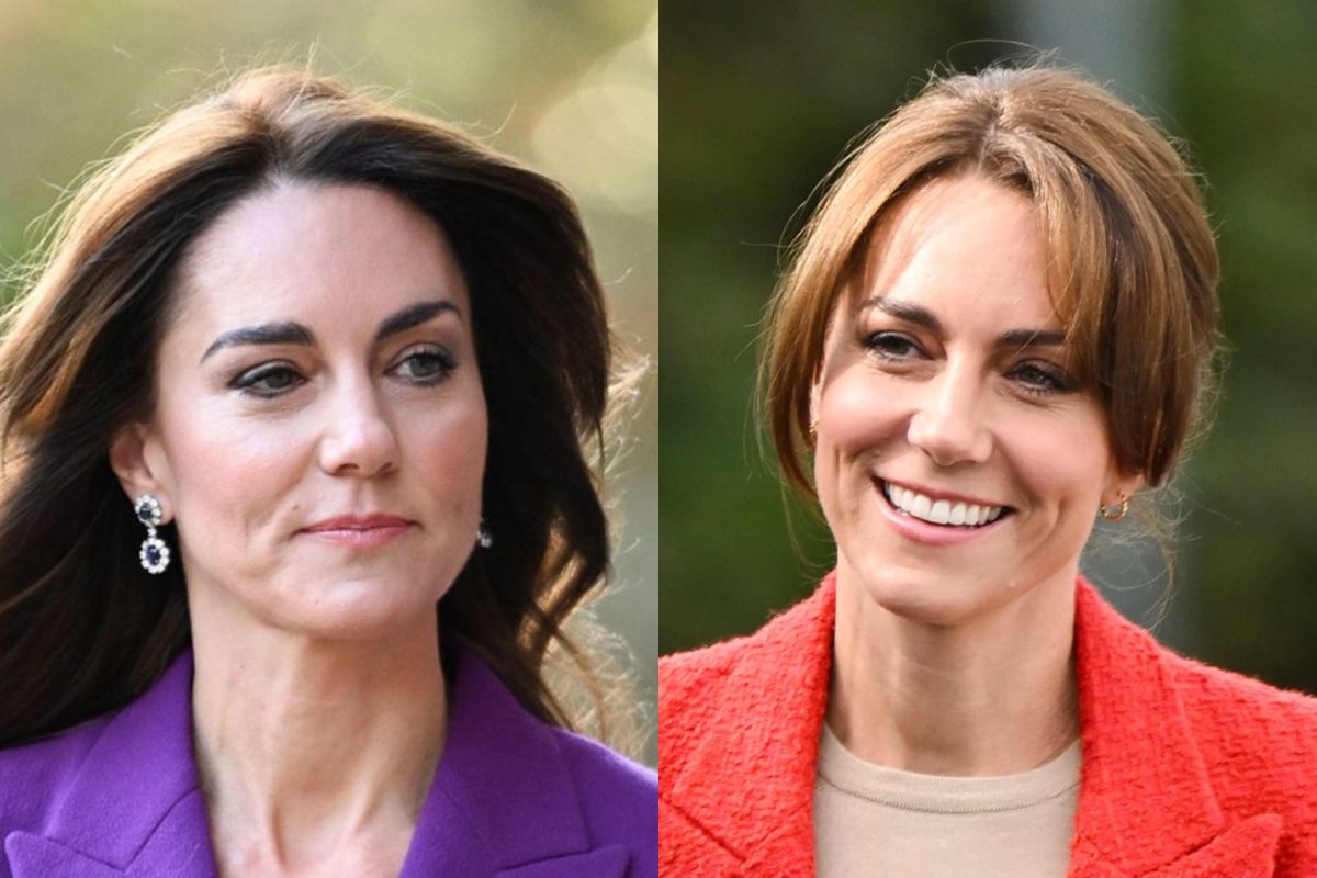 Kate Middleton se sometió a una cirugía estética y por eso desapareció del ojo público según rumores