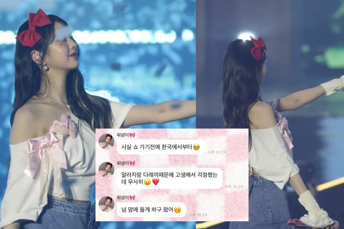 Wonyoung de IVE preocupa a sus fans al mostrarse con hematomas en su cuerpo